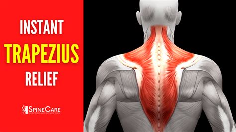 upper trapezius strain pain